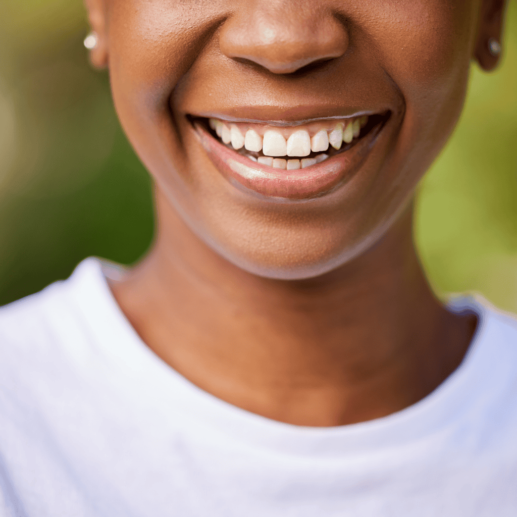 Teeth Whitening